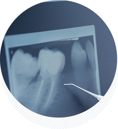 歯科用CTレントゲン