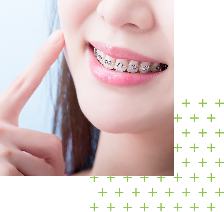 相談しやすい矯正治療